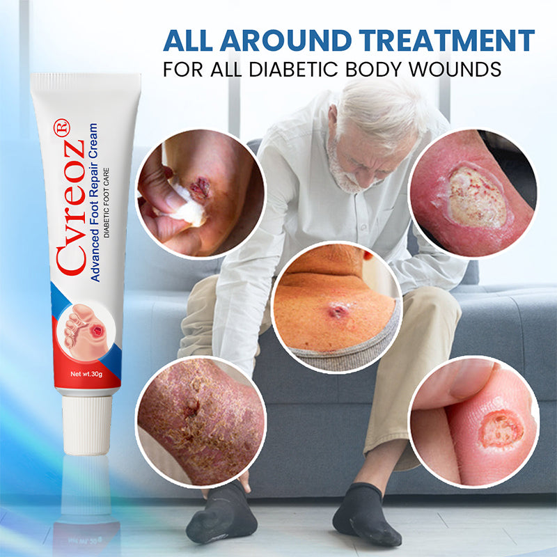 ⏰Last Day Promotion: 70% OFF 🔥Cvreoz® Advanced Foot Repair Cream