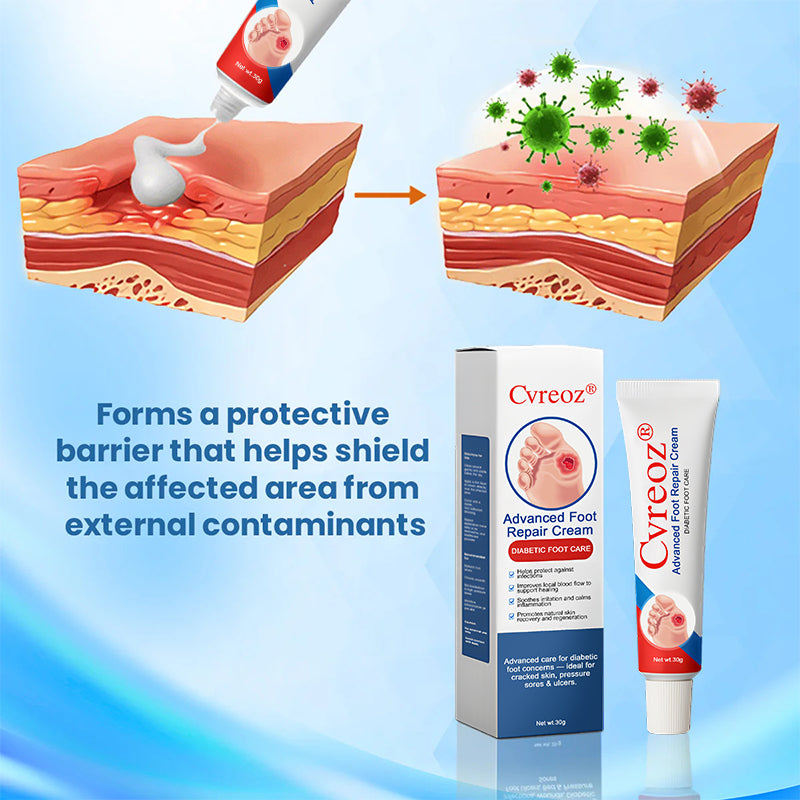 ⏰Last Day Promotion: 70% OFF 🔥Cvreoz® Advanced Foot Repair Cream