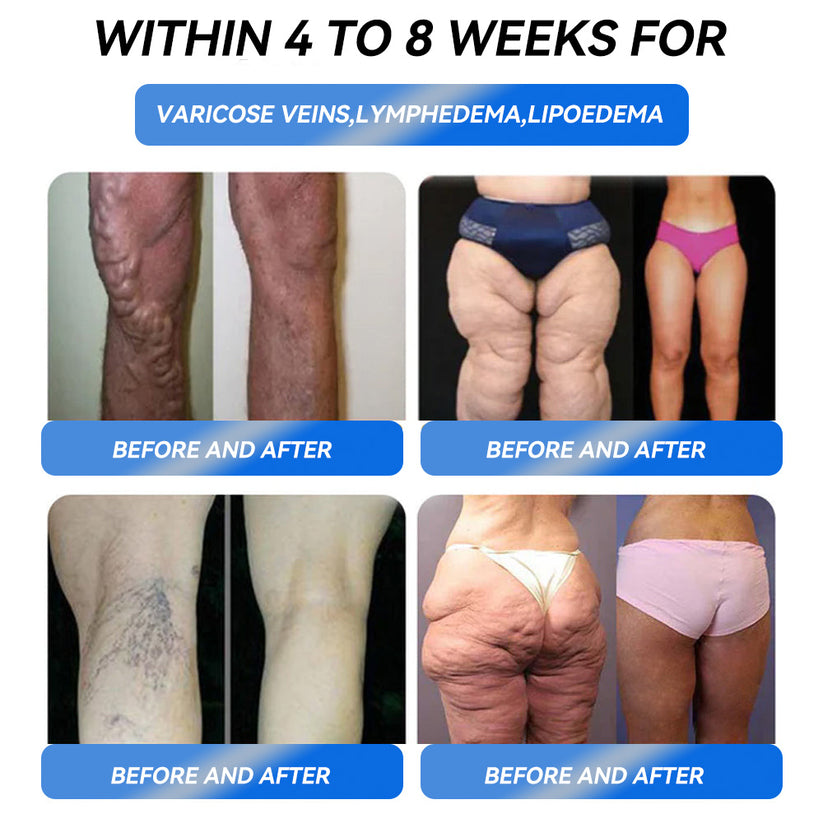 Honxi® GLP-1 Weight Loss Oral Solution ✅One dose a day — see results in 7 days👩⚕️Suitable for obesity, cardiovascular diseases, diabetes, sleep apnea, high cholesterol and blood lipids, joint problems, and various other conditions🚀