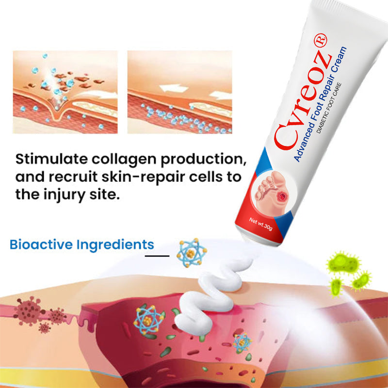 ⏰Last Day Promotion: 70% OFF 🔥Cvreoz® Advanced Foot Repair Cream