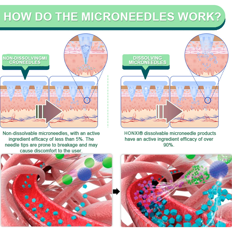 ใLast Day Promotion 60% OFF๐ใ๐๐ผ๐ป๐
๐ถยฎ Tirzepatide Slimming & health NANO MICRONEEDLE PATCH๐บ๐ธ๐๏ผZero Pain, 24/7 Release | Lose 20lbs FAST | 90% Sugar Drop | ๏ผ