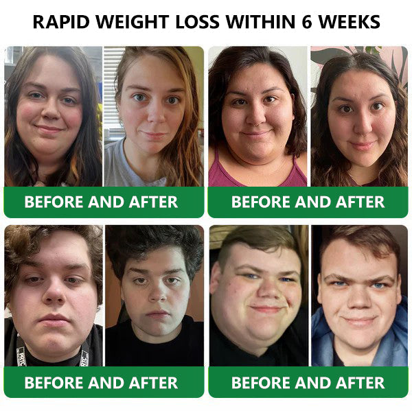 ใLast Day Promotion 60% OFF๐ใ๐๐ผ๐ป๐
๐ถยฎ Tirzepatide Slimming & health NANO MICRONEEDLE PATCH๐บ๐ธ๐๏ผZero Pain, 24/7 Release | Lose 20lbs FAST | 90% Sugar Drop | ๏ผ