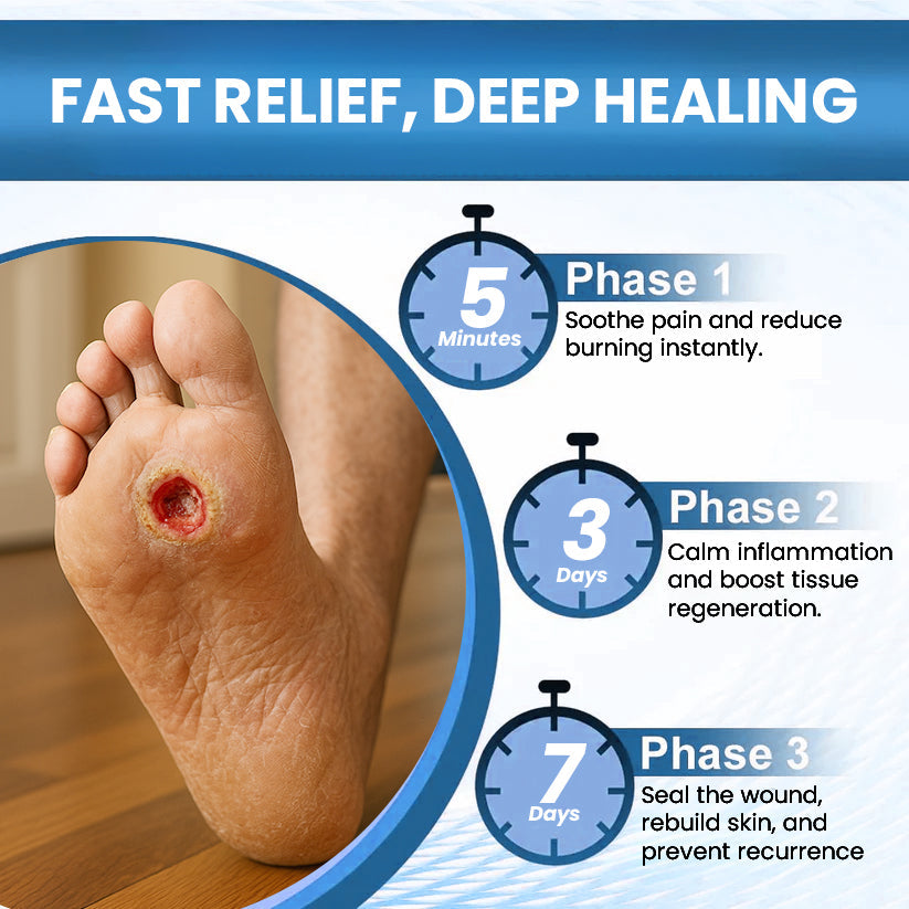 ⏰Last Day Promotion: 70% OFF 🔥Cvreoz® Advanced Foot Repair Cream