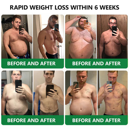 【Last Day Promotion 60% OFF💜】𝗛𝗼𝗻𝘅𝗶® Tirzepatide Slimming & health NANO MICRONEEDLE PATCH🇺🇸💜（Zero Pain, 24/7 Release | Lose 20lbs FAST | 90% Sugar Drop | ）