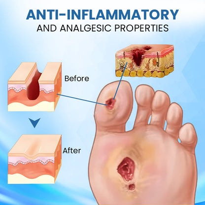 ⏰Last Day Promotion: 70% OFF 🔥Cvreoz® Advanced Foot Repair Cream